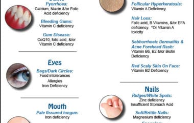 signs of nutrient deficiencies